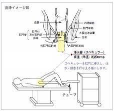 コロンハイドロセラピー ぴろぴろのハワイ美白日記